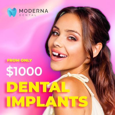 DENTAL IMPLANTS PROMO!!! Contact us now for more …